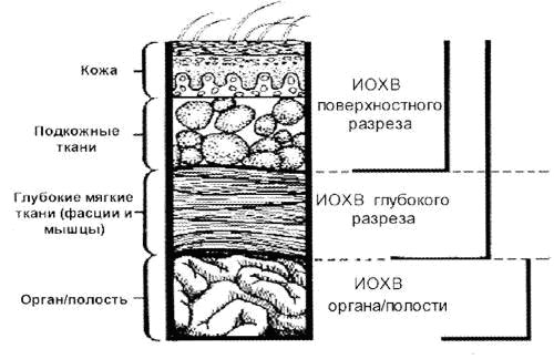 ИОХВ